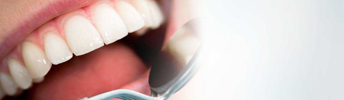 Oral hygiene requirements for those with implants