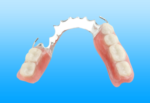 Partial dentures – a more affordable denture option