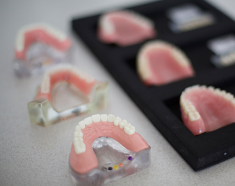 Learn more about Dentures: 11 most asked questions you may be wondering about