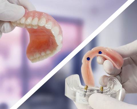 Dental Implants or Dentures – your options