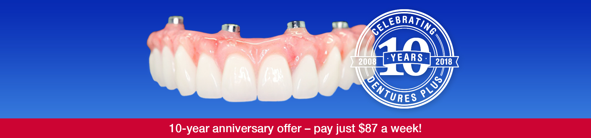 Full Arch Rehab on four dental implants (Four Under One) – special 10th anniversary special from just 16k!