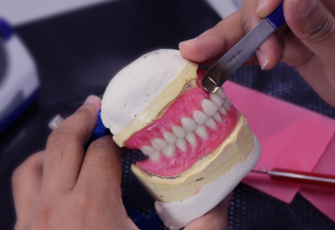 Denture being made in our in-house denture lab